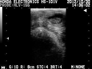 妊娠33日目の牛胎子の超音波画像